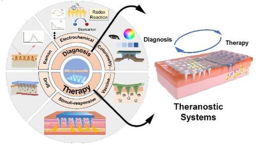 基于微针的生物医学系统 设计、制造与应用研究进展